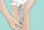 Connecting and changing a drainage or leg bag