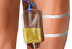 Leg bag