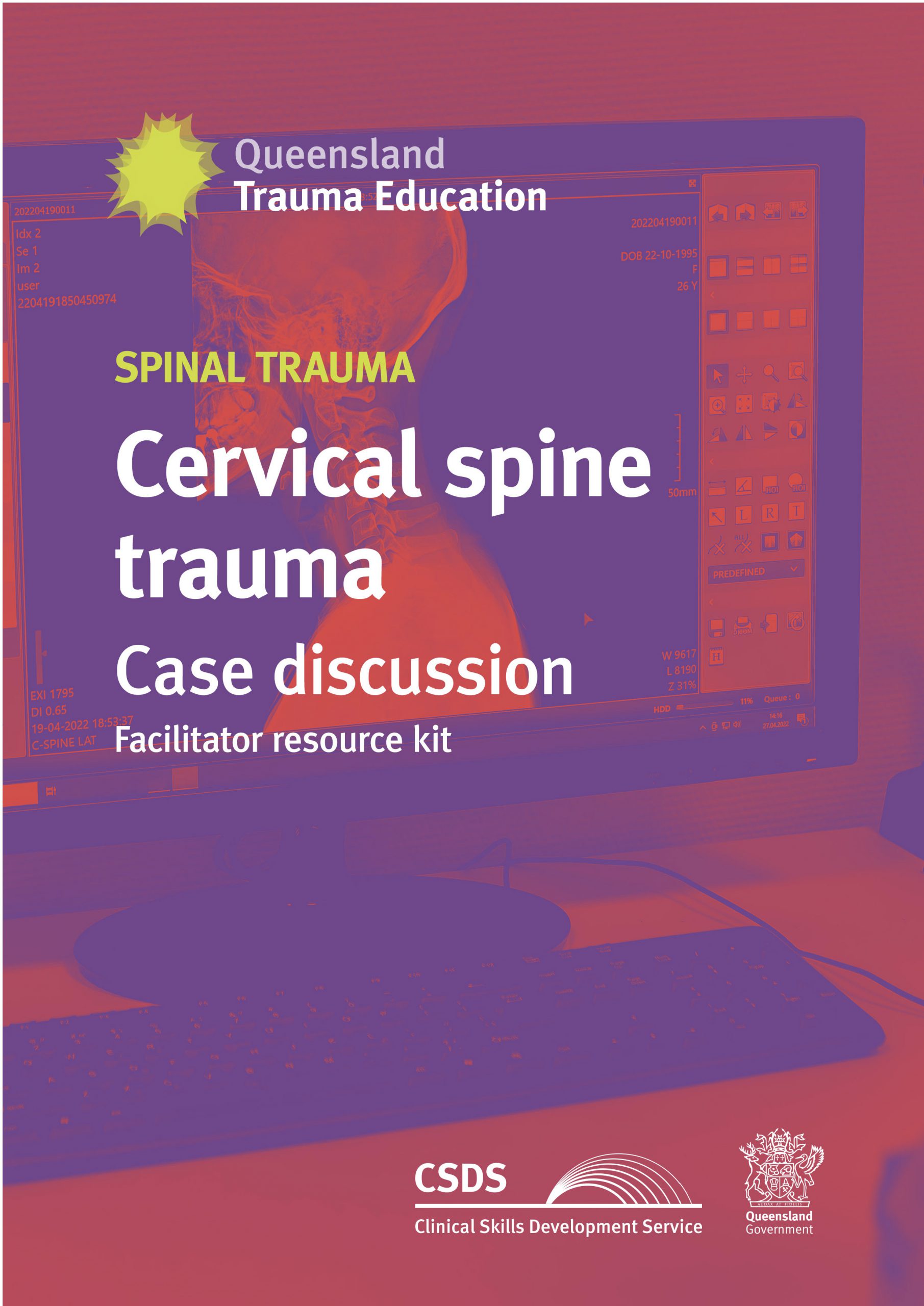 Cover image of Cervical spine trauma